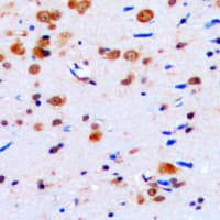 Polyclonal Rabbit anti-Human CELF1 / CUGBP1 Antibody (Internal, IHC, IF, WB)