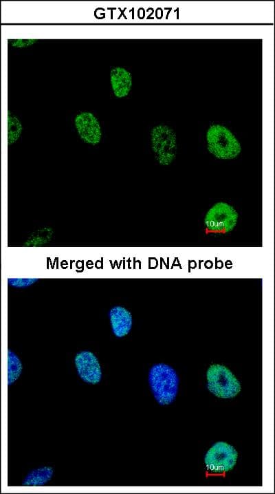 NXF1 / TAP Antibody (aa1-151)
