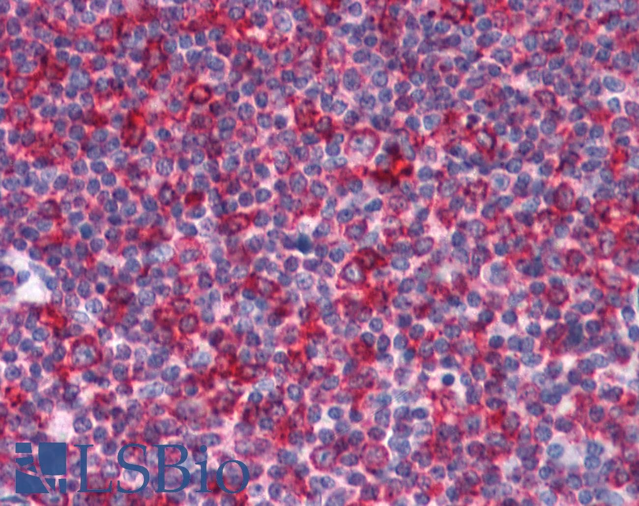 IHC-plus™ Polyclonal Rabbit anti-Human EFHD2 Antibody (IHC, IF, WB)