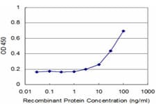 TPM2 Antibody (clone 3C8)