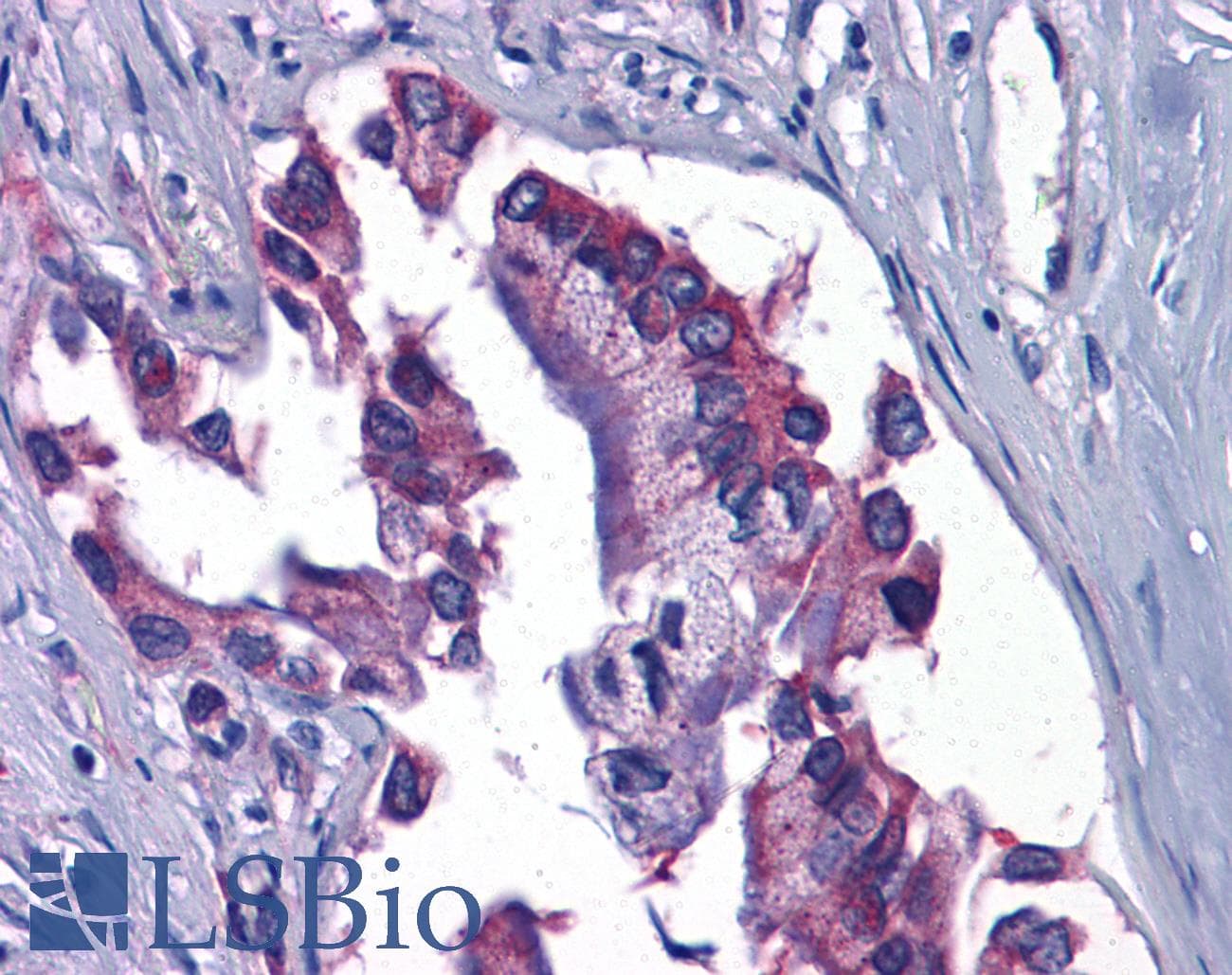 IHC-plus™ GFPT1 / GFAT Antibody (C-Terminus)