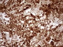 MKI67 / Ki67 Antibody (aa1160-1493, clone OTI5E6)