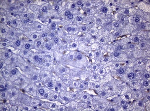 Monoclonal Mouse anti-Human CD38 Antibody (clone OTI1C9, aa43-300, IHC, WB)