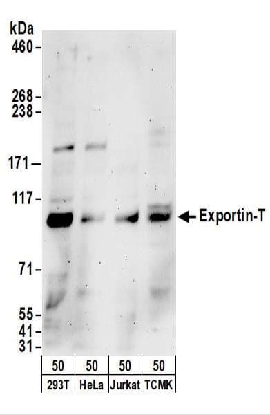 IHC-plus™ Polyclonal Rabbit anti-Human XPOT / Exportin-T Antibody (aa825-875, IHC, WB)