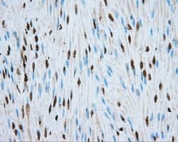 HMRF1L / MTRF1L Antibody (clone OTI2B5)