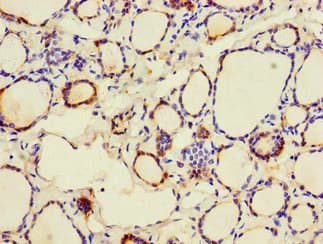 CALR / Calreticulin Antibody