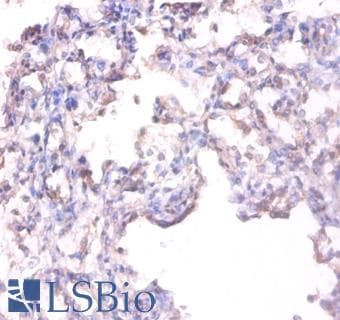 IHC-plus™ ALPL / Alkaline Phosphatase Antibody (aa 28-501)