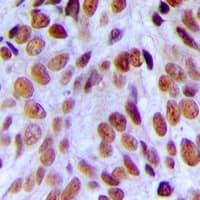 Polyclonal Rabbit anti-Human NCBP1 / CBP80 Antibody (N-Terminus, IHC, WB)