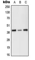 Polyclonal Rabbit anti-Human PRKX Antibody (Internal, WB)