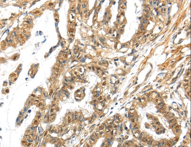 APOL6 / Apolipoprotein L 6 Antibody