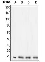 STMN1 / Stathmin / LAG Antibody (N-Terminus)