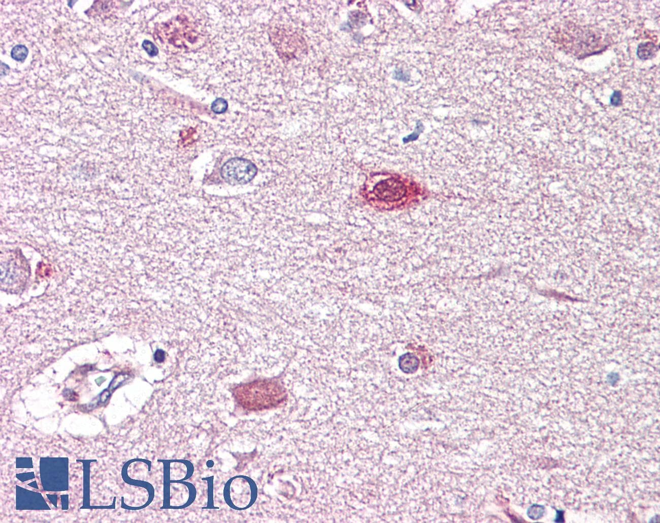 PathPlus™ GAD1 / GAD67 Antibody (aa471-520)