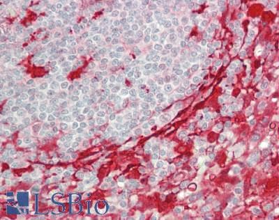 IHC-plus™ KCTD12 Antibody (aa125-175)