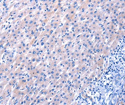 Polyclonal Rabbit anti-Human EGF Antibody (IHC, WB)