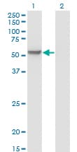 MPP1 Antibody (clone 1E11-1G11)