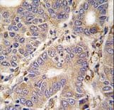 CARS2 Antibody (aa536-564)