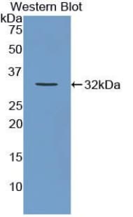 VCAN / Versican Antibody (aa3058-3299)