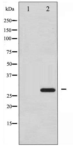 HSPB1 / HSP27 Antibody (phospho-Ser15)