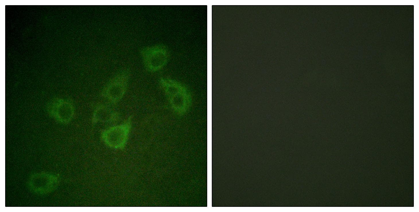 Polyclonal Rabbit anti-Human CASP6 / Caspase 6 Antibody (phospho-Ser257, IHC, IF, WB)