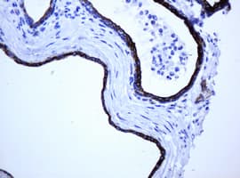 ABCB1 / MDR1 / P Glycoprotein Antibody (aa995-1280, clone 6H2, Carrier-free)
