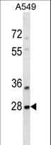 SNF8 / EAP30 Antibody (aa37-65)
