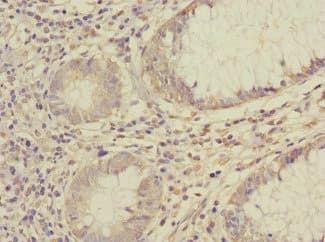 SAE1 Antibody