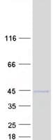 Human SNX11 Protein (Recombinant Myc-DDK (Flag))