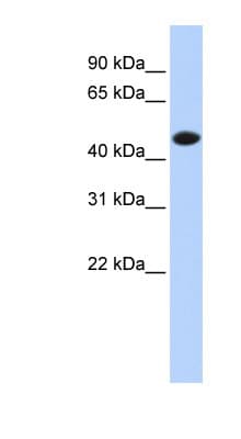 CKM / Creatine Kinase MM Antibody (aa72-121)