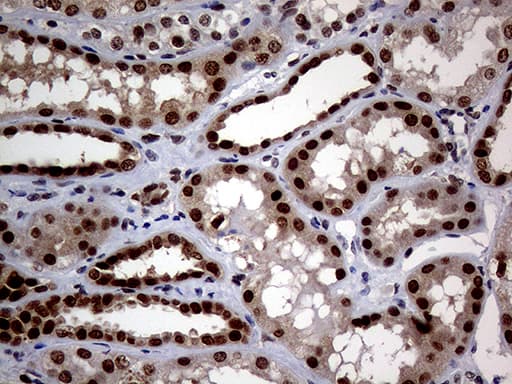 MGMT Antibody (clone OTI6G6)