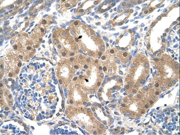 SLC39A6 / LIV-1 Antibody (aa26-75)