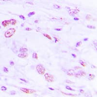 ATF2 Antibody (phospho-Ser112)