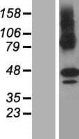 ZDHHC11 Protein (Over-Expression Lysate Myc-DDK (Flag))