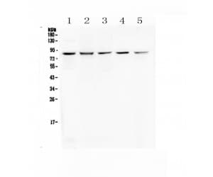 Polyclonal Rabbit anti-Human RNF43 Antibody (WB)