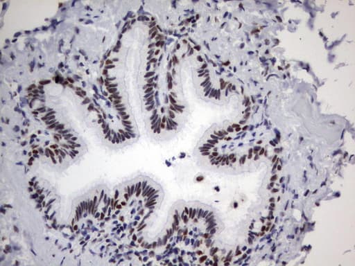 PARN Antibody (aa1-266, clone UMAB143)