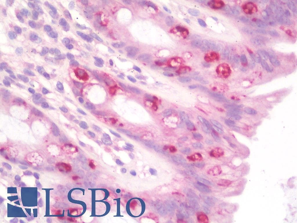 IHC-plus™ GRK6 Antibody