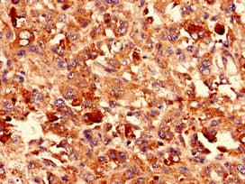 CDH3 / P-Cadherin Antibody (aa117-360)