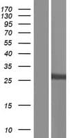 Human SULT1A1 / Sulfotransferase 1A1 Protein (Over-Expression Lysate Myc-DDK (Flag))