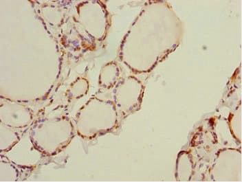 Polyclonal Rabbit anti-Human DTX2 Antibody (IHC, WB)