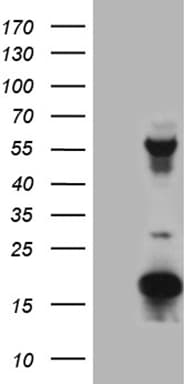 TYW2 / TRMT12 Antibody (clone OTI8C7, Carrier-free)