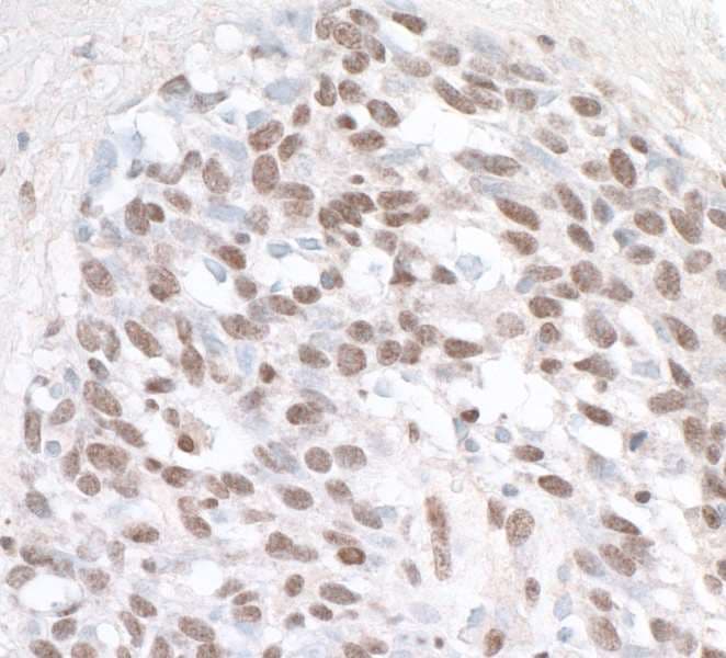 ZHX1 Antibody (aa1-50)