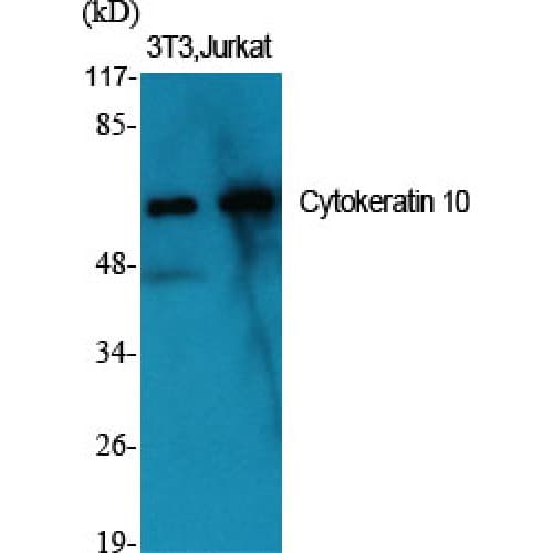 KRT10 / CK10 / Cytokeratin 10 Antibody (110-190 aa, Internal)