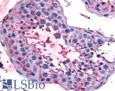 IHC-plus™ BEST2 / Bestrophin-2 Antibody (Internal)