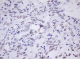 MORF4 Antibody (aa1-255, clone OTI5F2, Carrier-free)