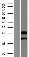 CCDC46 Protein (Over-Expression Lysate Myc-DDK (Flag))