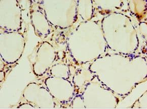SULT1C2 / Sulfotransferase 1C2 Antibody (aa1-120)