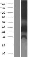 ZFYVE1 / DFCP1 Protein (Over-Expression Lysate Myc-DDK (Flag))