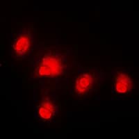 RAF1 / RAF Antibody (Internal)