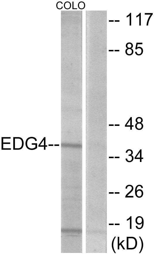 Polyclonal Rabbit anti-Human LPAR2 / EDG4 Antibody (IF, WB)