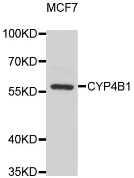 Polyclonal Rabbit anti-Human CYP4B1 Antibody (IHC, WB)