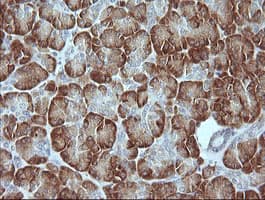 MAPK9 / JNK2 Antibody (clone OTI4D1)